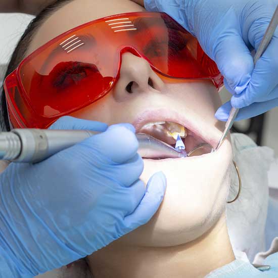 Tooth Decay