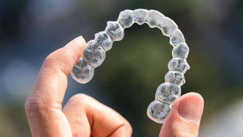 Invisalign for a Flawless Smile