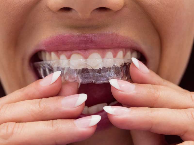 Orthodontics at Forest Hill