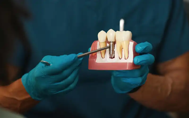 Who is not a good candidate for dental implants?
