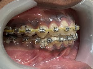 Dental at Forest Hill place picture